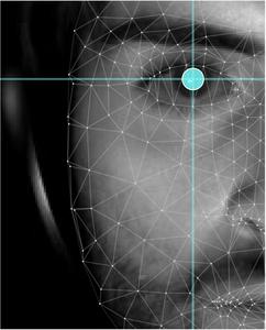 Tinnitus pupil dilation