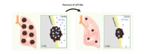 Pleural cavity macrophages infiltrate lung tumors and promote progression. Their depletion or Gata6 deletion suppresses tumors and enhances immunity