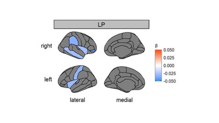 Regional brain volume differences in children born late preterm