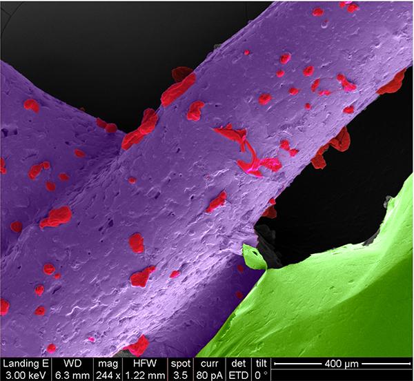Bone Construction