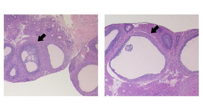 Ovaries after eCG administration