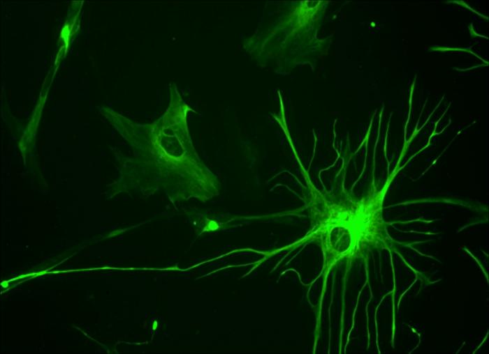 Astrocytes May Hold the Key to Understanding Chronic Traumatic Encephalopathy