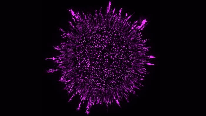 A laboratory-grown Pseudomonas aeruginosa biofilm.