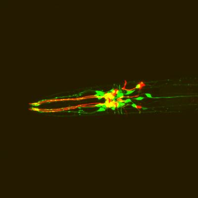 Worm Research May Explain Some Drug Effects in Humans