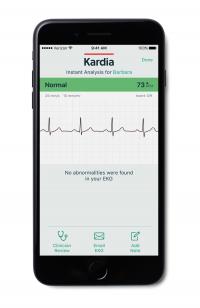 Novel Technology May Enable More Efficient Atrial Fibrillation Monitoring and Detection (2 of 2)