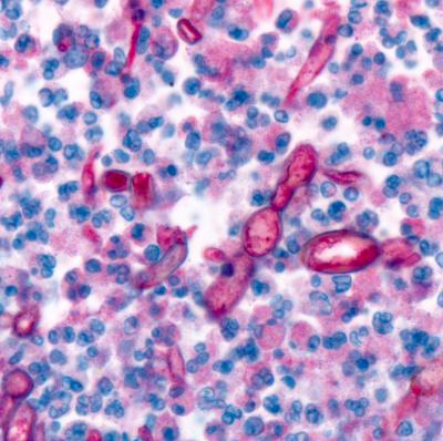 <i>Exserohilum</i> Fungal Hyphae