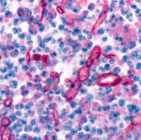 <i>Exserohilum</i> Fungal Hyphae