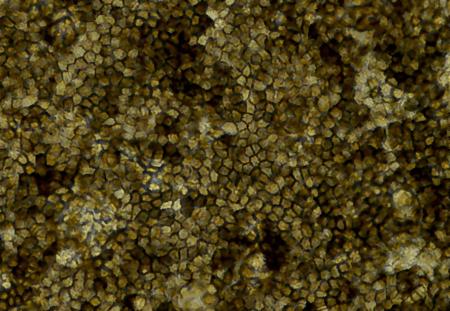 iPSC RPE Light Microscopy, University of California San Diego School of Medicine