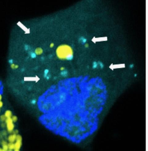 Nanoparticles
