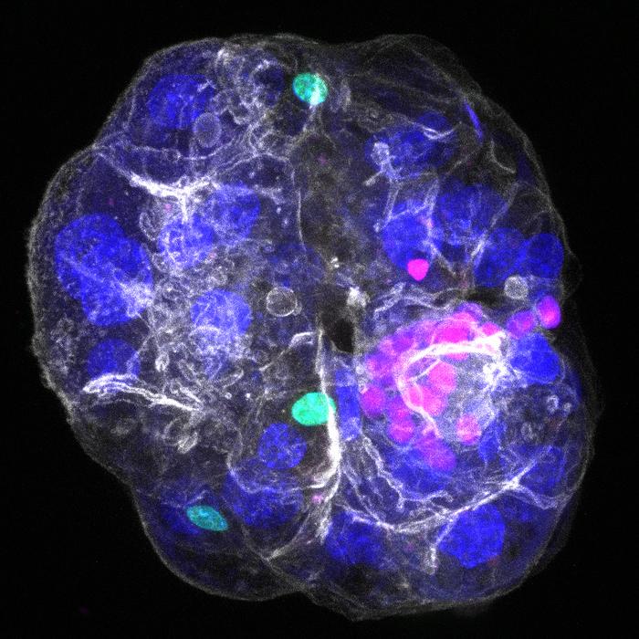 Periportal assembloid