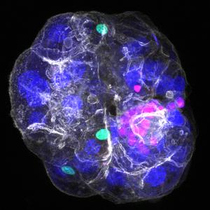 Periportal assembloid