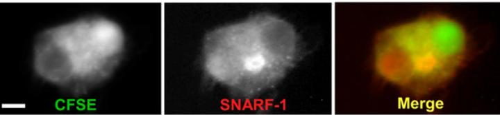 'Genomic Catastrophe' May Cause Normal Cells to  Become Cancerous