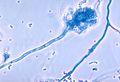 <i>Aspergillus fumigatus</i>