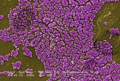Slowing the Spread of Drug-Resistant Diseases Is Goal of New Research Area