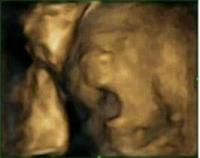 Yawn at 27.5 Weeks