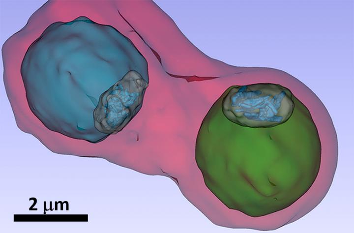 Plasmodia in Blood Cell