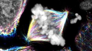 A metaphase spindle in a human ovarian cancer cell