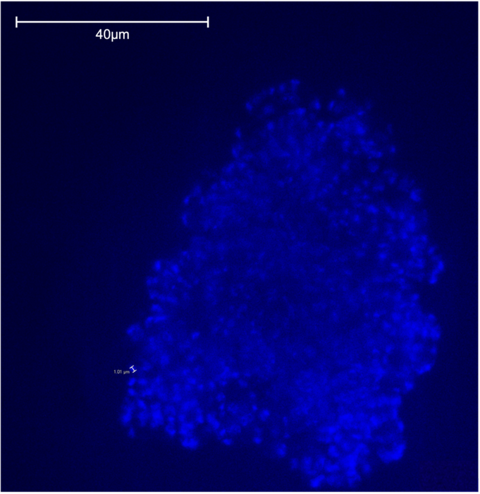 A microscopic picture of a methanogen