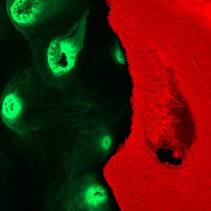 Black Band Disease under the fluorescence microscope