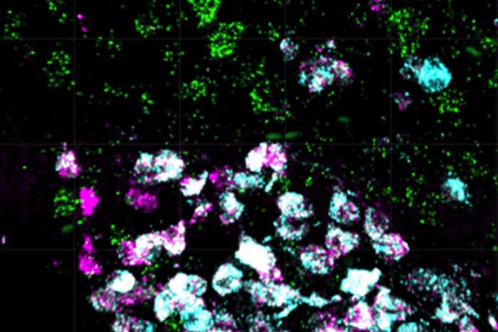 Microscopic image of nerve cells in the mouse brain.