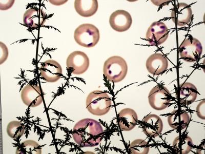Artemisia Superimposed on Malaria-Infected Red Blood Cells