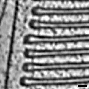 Cryo-ET with VPP reveals individual proteins in native settings
