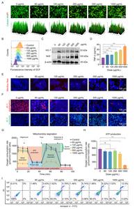 Figure 3. PS NPs induced the hierarchical oxidative stress responses in RAW 264.7 cells.