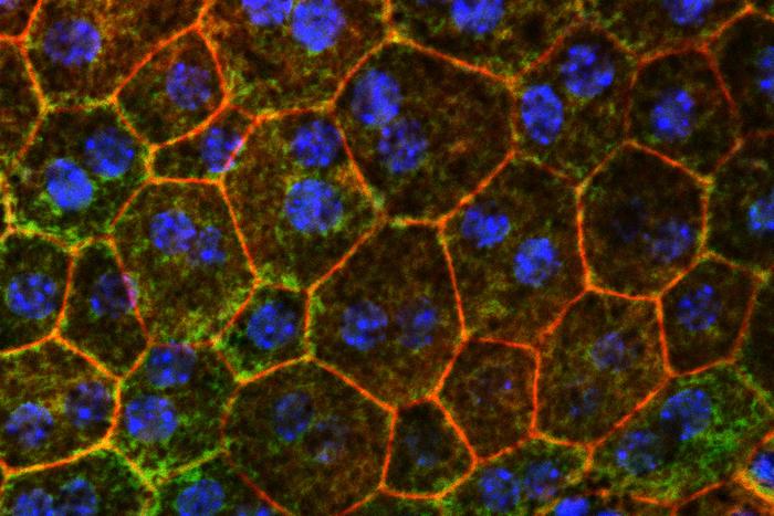 Strategy to prevent age-related macular degeneration identified