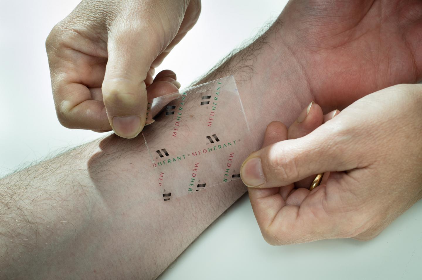 Researchers Create World's First Ibuprofen Patch