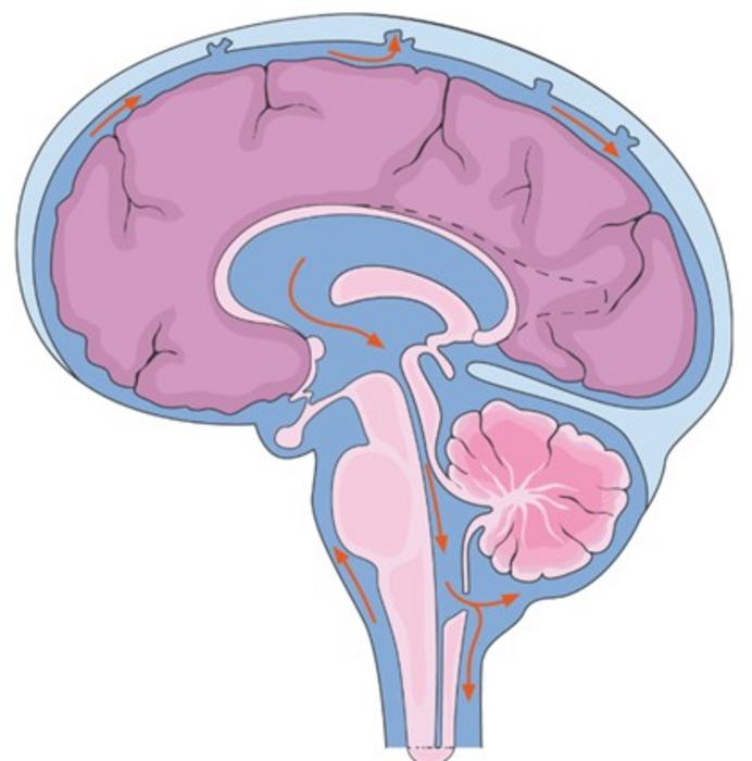 Cerebrospinal Fluid Dynamics in Refractory Hydrocephalus