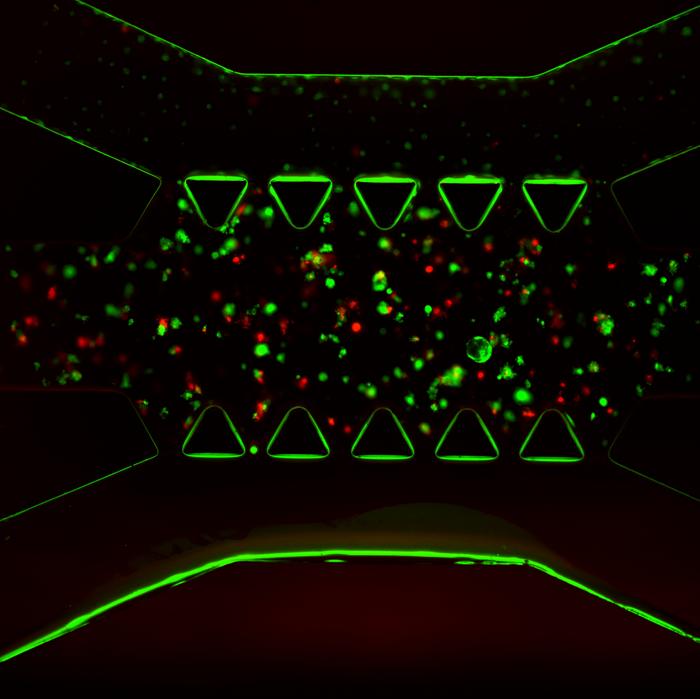 A cancer-on-a-chip model