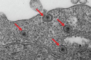 Rotavirus trapped in endosomes in cells