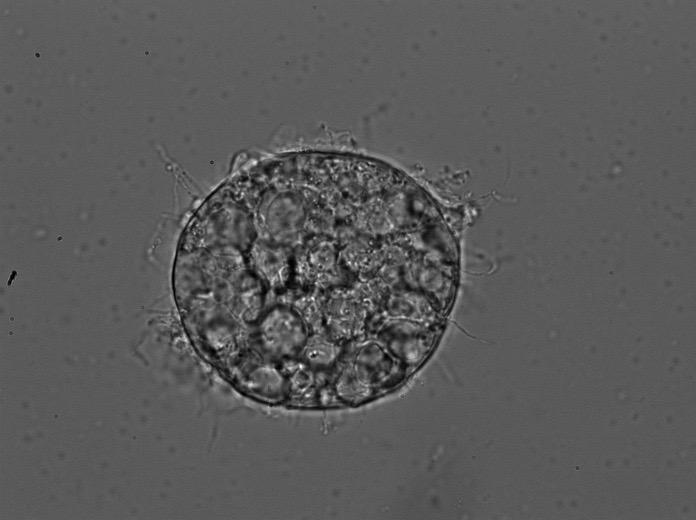 Microscopy image of fungus