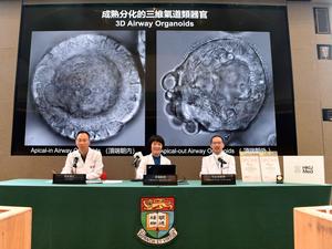 HKUMed researchers