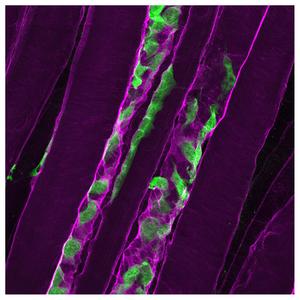 Muscle cells