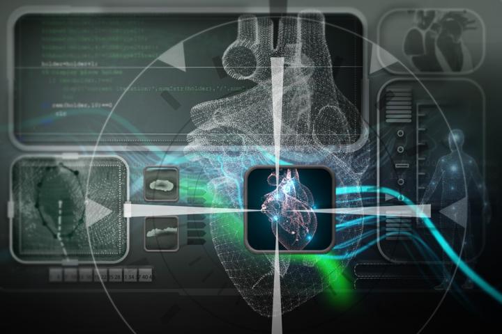 Novel Algorithm Doesn't Require Special Catheters or 3D Map of the Heart