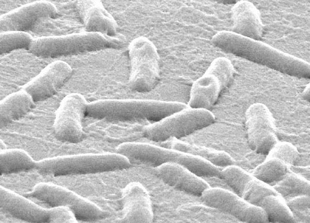 <i>Pseudomonas aeruginosa</i> on Plastic