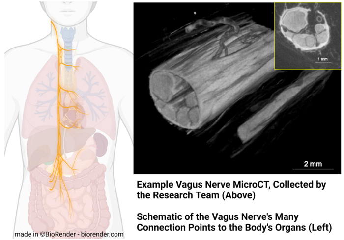 Vagus nerve