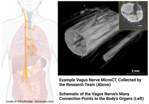 Vagus nerve