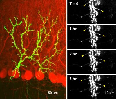 Time-Lapse Images Reveal Motile Axons in the Adult Brain