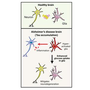 Enhanced glucose uptake in glial cells might help fight AD.