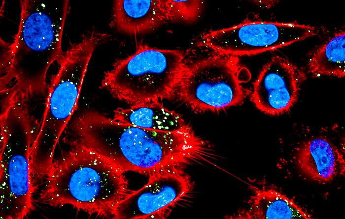 Melanoma cells and vesicles secreted by macrophages
