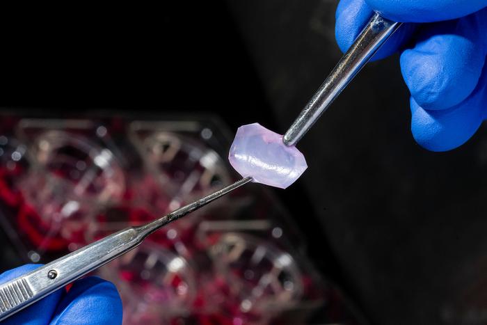 Lab-grown skin that is designed to be used in treating fibrotic skin diseases