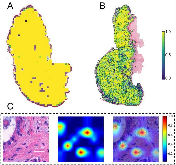 Model interpretability heatmap.