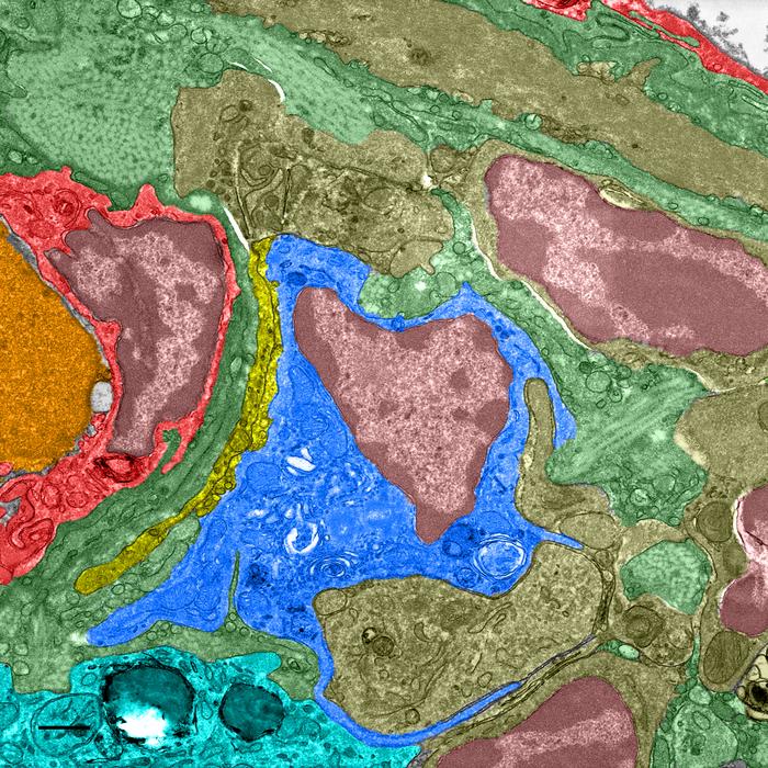 Electron microscopy image of pigeon liver tissue