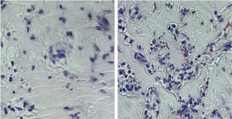Endothelial Cells