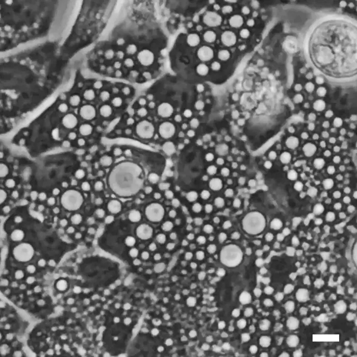 Vacuoles