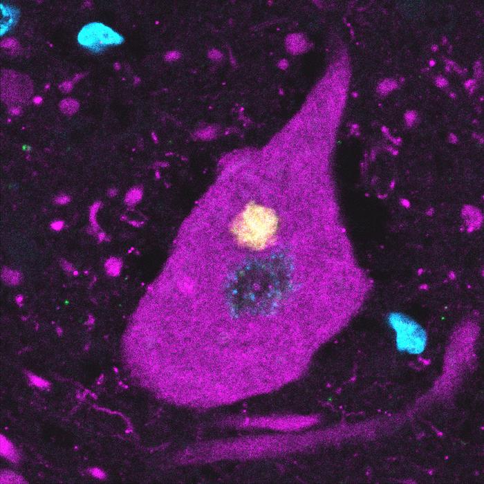 Yamanaka-TDP43-Cell