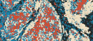 Tumour containing infiltrating neutrophils