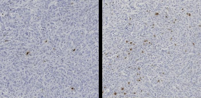 Mouse pancreatic tumor cells before and after novel treatment